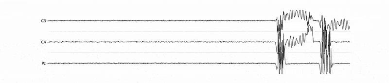 Projects section banner